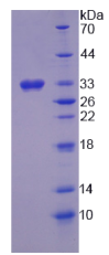 17-β-羟基类固醇脱氢酶3(HSD17β3)重组蛋白