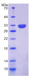 17-β-羟基类固醇脱氢酶14(HSD17β14)重组蛋白