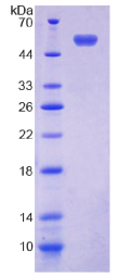 153kDa核孔蛋白(NUP153)重组蛋白