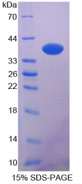 N-myc下游调节基因2(NDRG2)重组蛋白