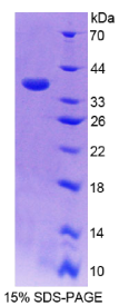 17-α-羟化酶(S17αH)重组蛋白