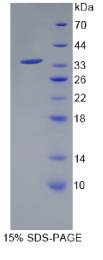 17-β-羟基类固醇脱氢酶1(HSD17β1)重组蛋白