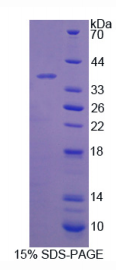 17-β-羟基类固醇脱氢酶12(HSD17β12)重组蛋白
