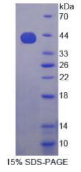 胰岛素样生长因子2-mRNA结合蛋白3(IGF2BP3)重组蛋白
