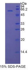 17-β-羟基类固醇脱氢酶12(HSD17β12)重组蛋白
