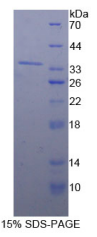 98kDa核孔蛋白(NUP98)重组蛋白