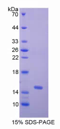G补缀FHA域血管生成因子1(AGGF1)重组蛋白