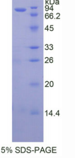 90kDa热休克蛋白αB1(HSP90αB1)重组蛋白