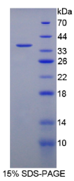 11-β-羟基类固醇脱氢酶1(HSD11β1)重组蛋白