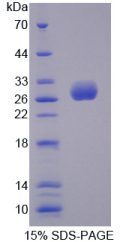 UL16结合蛋白2(ULBP2)重组蛋白