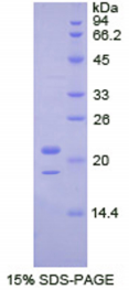 43kDa Tar DNA结合蛋白(TDP43)重组蛋白