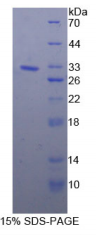 90kDa热休克蛋白β1(HSP90β1)重组蛋白