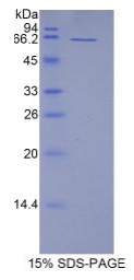 CD5抗原样蛋白(CD5L)重组蛋白