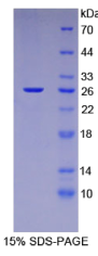 133kDa核孔蛋白(NUP133)重组蛋白