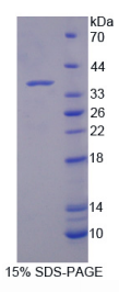 214kDa核孔蛋白(NUP214)重组蛋白