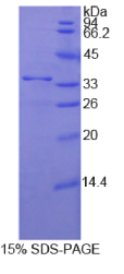 205kDa核孔蛋白(NUP205)重组蛋白