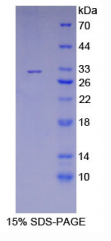90kDa热休克蛋白β1(HSP90β1)重组蛋白