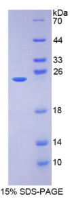 17-β-羟基类固醇脱氢酶10(HSD17β10)重组蛋白