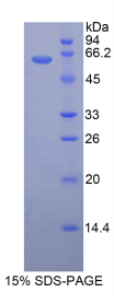 17-β-羟基类固醇脱氢酶12(HSD17β12)重组蛋白