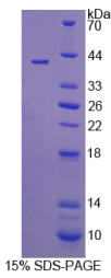 11-β-羟基类固醇脱氢酶2(HSD11β2)重组蛋白