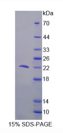 细胞程序性死亡蛋白6(PDCD6)重组蛋白