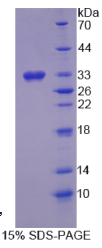 11-β-羟基类固醇脱氢酶3(HSD11β3)重组蛋白