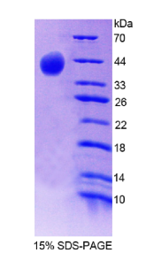 补体成分8β(C8β)重组蛋白