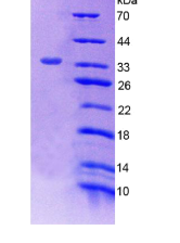 肿瘤蛋白p53(TP53)重组蛋白