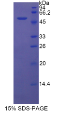 Dickkopf相关蛋白1(DKK1)重组蛋白