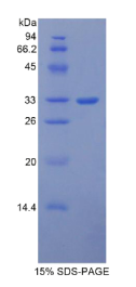 中间α-球蛋白抑制因子H1(ITIH1)重组蛋白