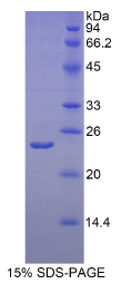 低氧诱导因子2α(HIF2α)重组蛋白