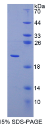 CD8a分子(CD8a)重组蛋白