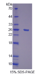 DNA指导聚合酶γ1(POLγ1)重组蛋白