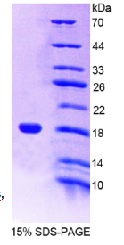 CD7分子(CD7)重组蛋白
