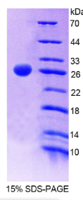 CD6分子(CD6)重组蛋白