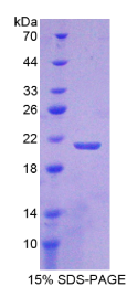 层粘连蛋白β2(LAMβ2)重组蛋白