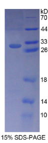 B-细胞淋巴瘤因子10(Bcl10)重组蛋白