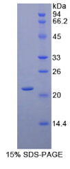 CD8b分子(CD8b)重组蛋白