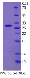 ATP结合盒转运蛋白C4(ABCC4)重组蛋白