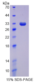 DNA甲基转移酶1(DNMT1)重组蛋白