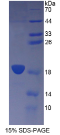 CD164分子(CD164)重组蛋白