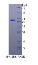 转化生长因子β1诱导转录因子1(TGFβ1I1)重组蛋白