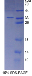 B-细胞淋巴瘤因子10(Bcl10)重组蛋白