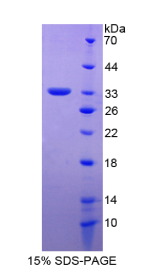 淀粉样蛋白β前体蛋白结合蛋白A2(APBA2)重组蛋白
