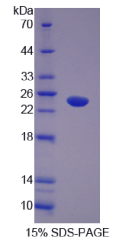Abl交互子1(ABI1)重组蛋白