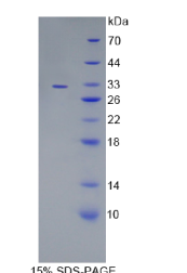多胺调节因子1结合蛋白1(PMFBP1)重组蛋白