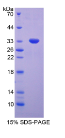 肿瘤蛋白p53(TP53)重组蛋白