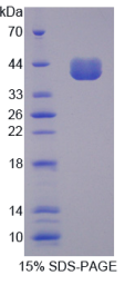 CD14分子(CD14)重组蛋白
