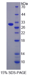 ATP结合盒转运蛋白B5(ABCB5)重组蛋白