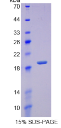 再生胰岛衍生蛋白3γ(REG3γ)重组蛋白